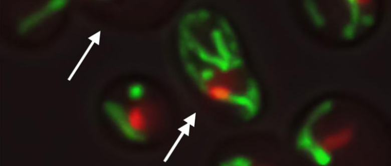 Prolungare La Vita, è Possibile?